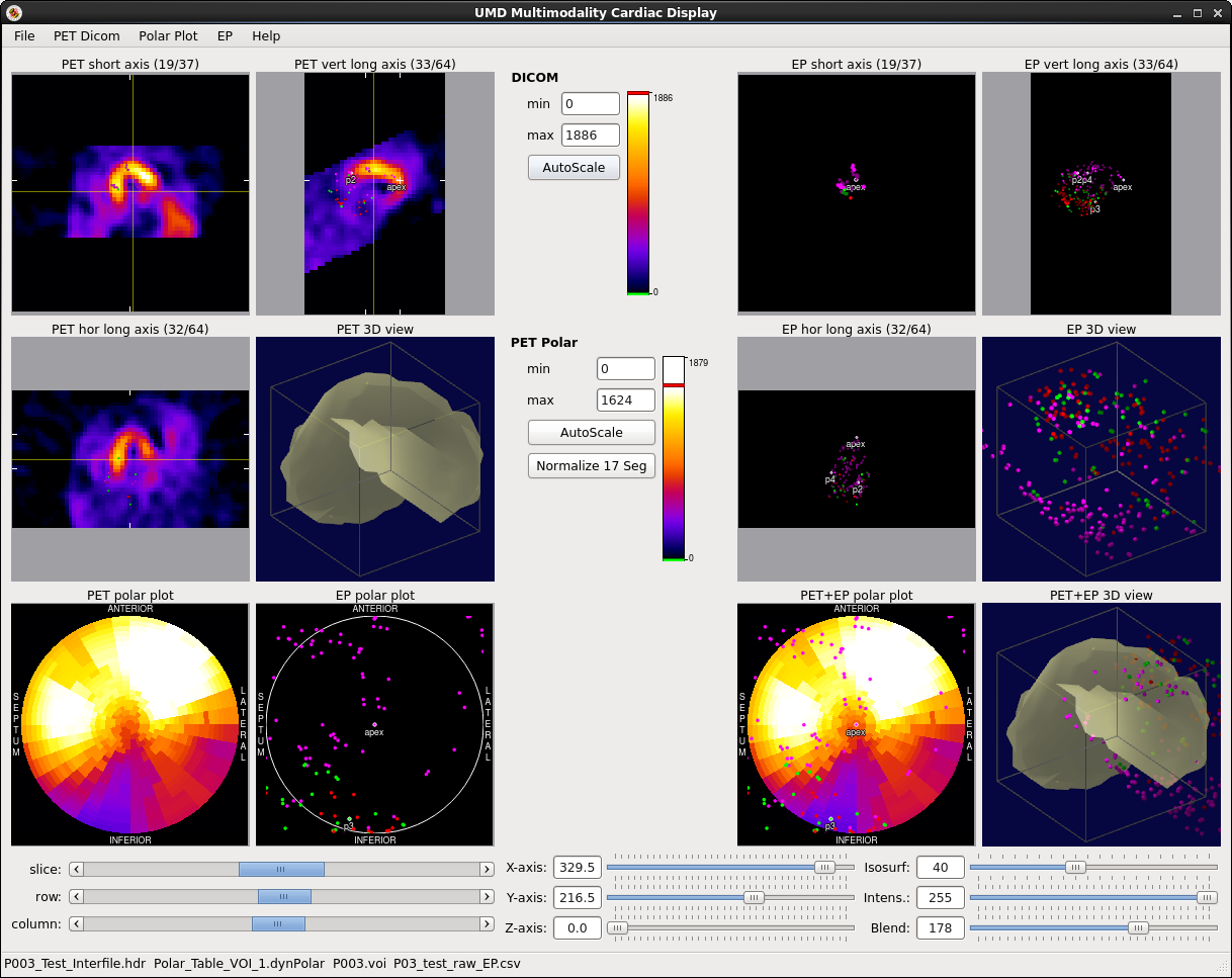 CardioViewer: Multimodality Cardiac Display